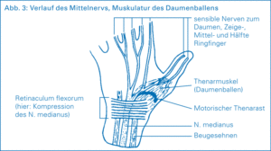 Schemazeichnung einer Hand und deren Sehnen und Nervenbahnen zur Erklärung des Karpaltunnelsyndroms